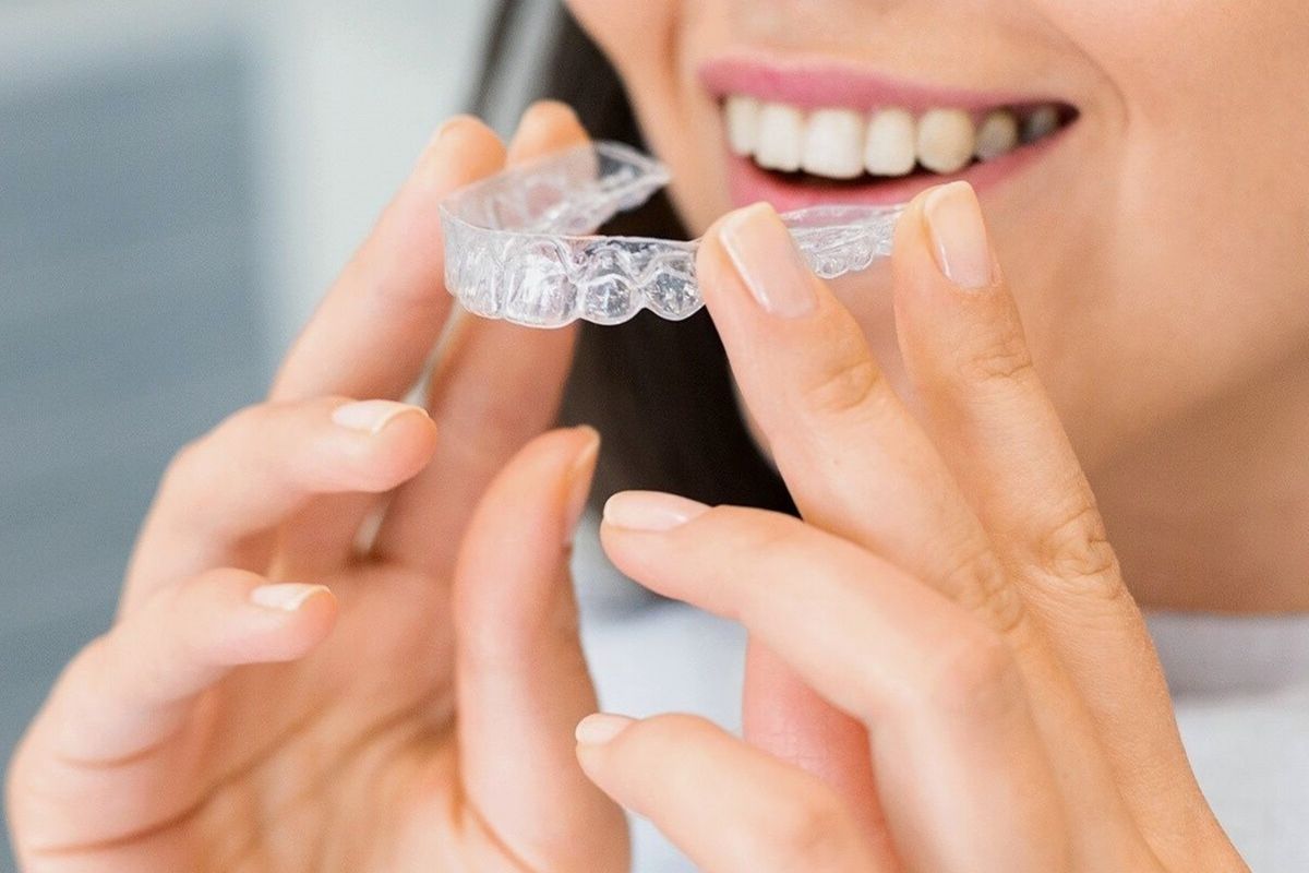 Mujer sosteniendo un alineador transparente