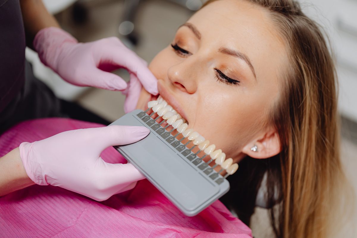 Dentista comparando el tono de los dientes con una guía de color