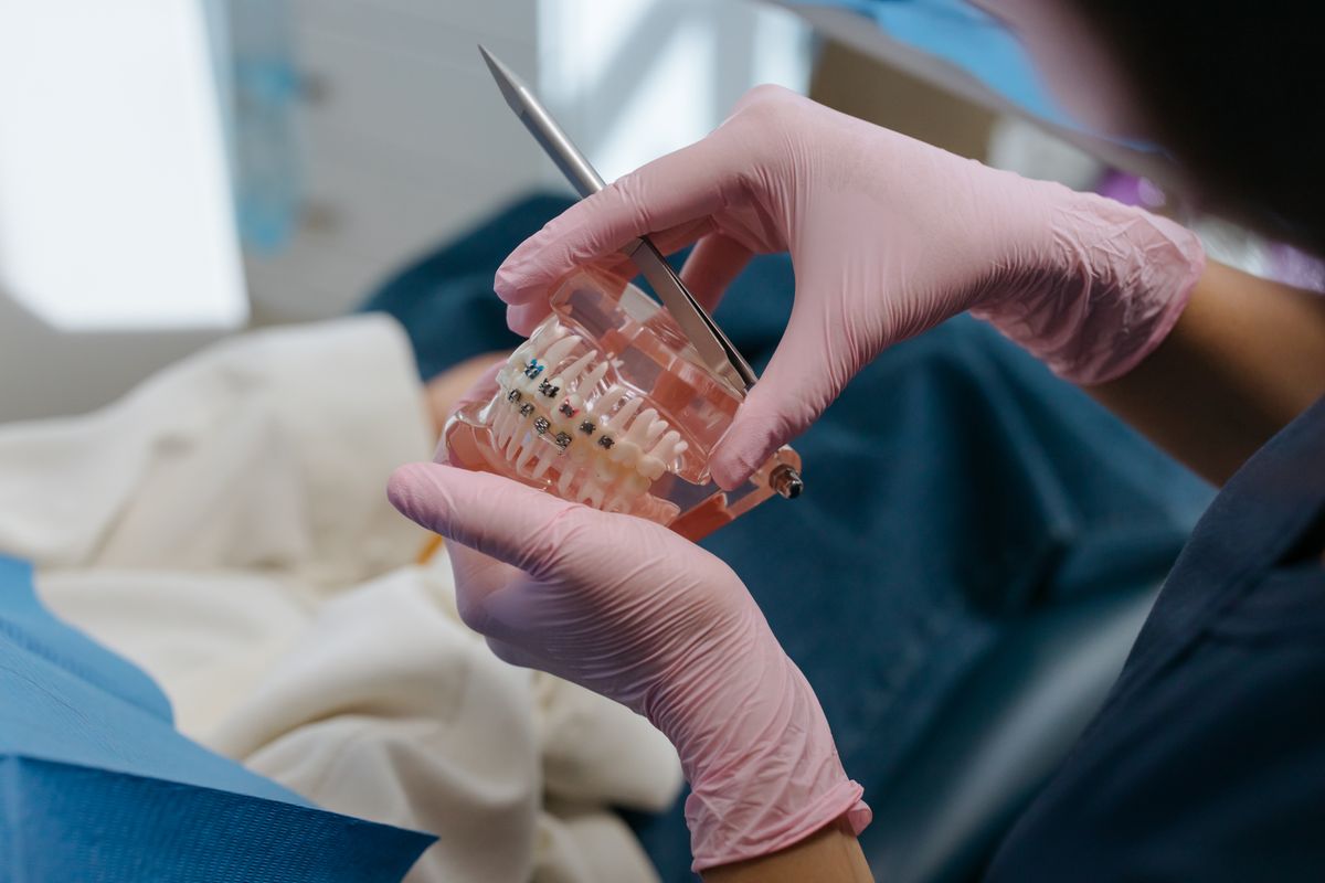 Manos con guantes sosteniendo un modelo dental con brackets