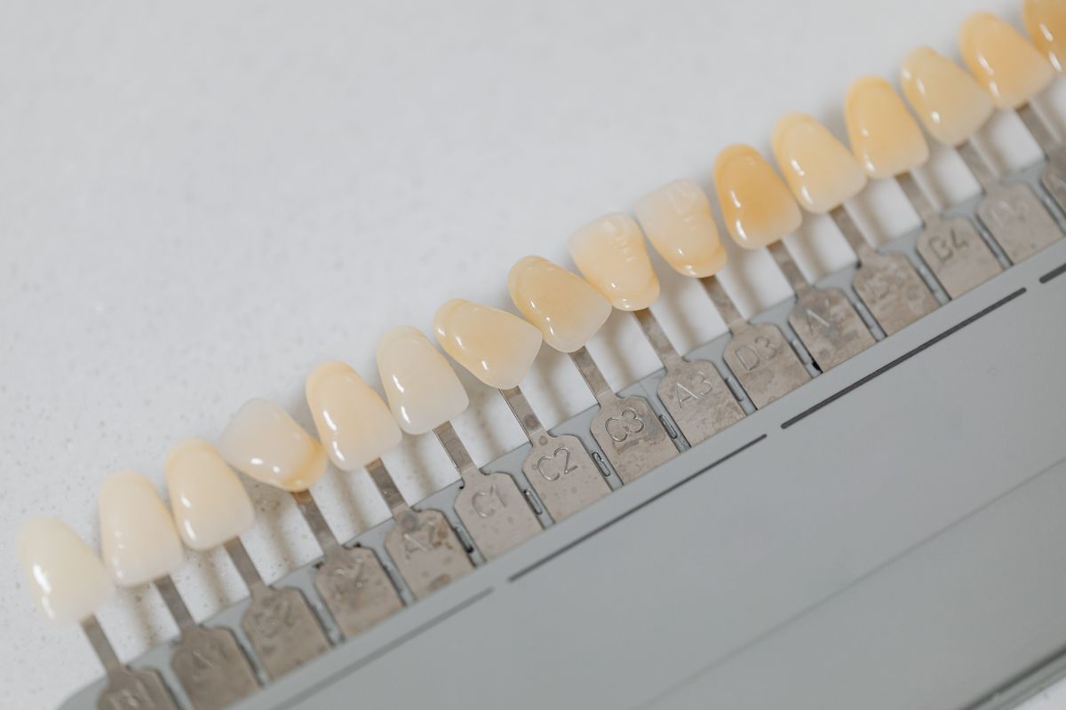 Muestrario de piezas dentales de distintos tonos
