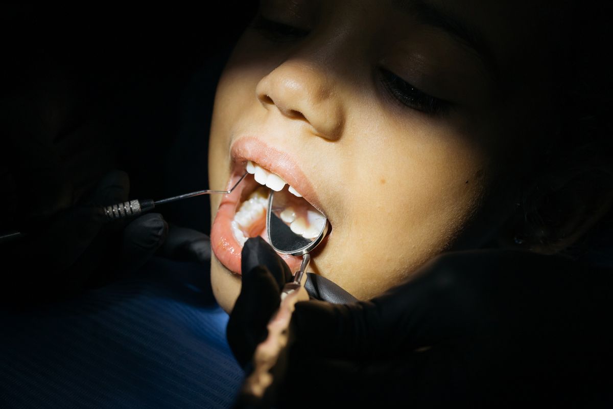 Revisión dental de una niña con espejo bucal