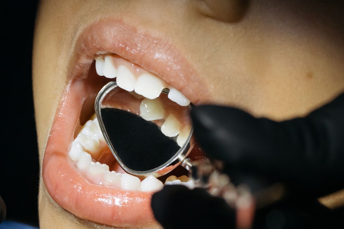 Primer plano de la boca de un niño durante una revisión dental con espejo